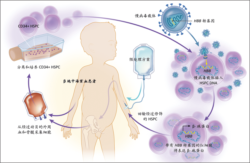 1-慢病毒载体基因治疗流程图_中文版.png